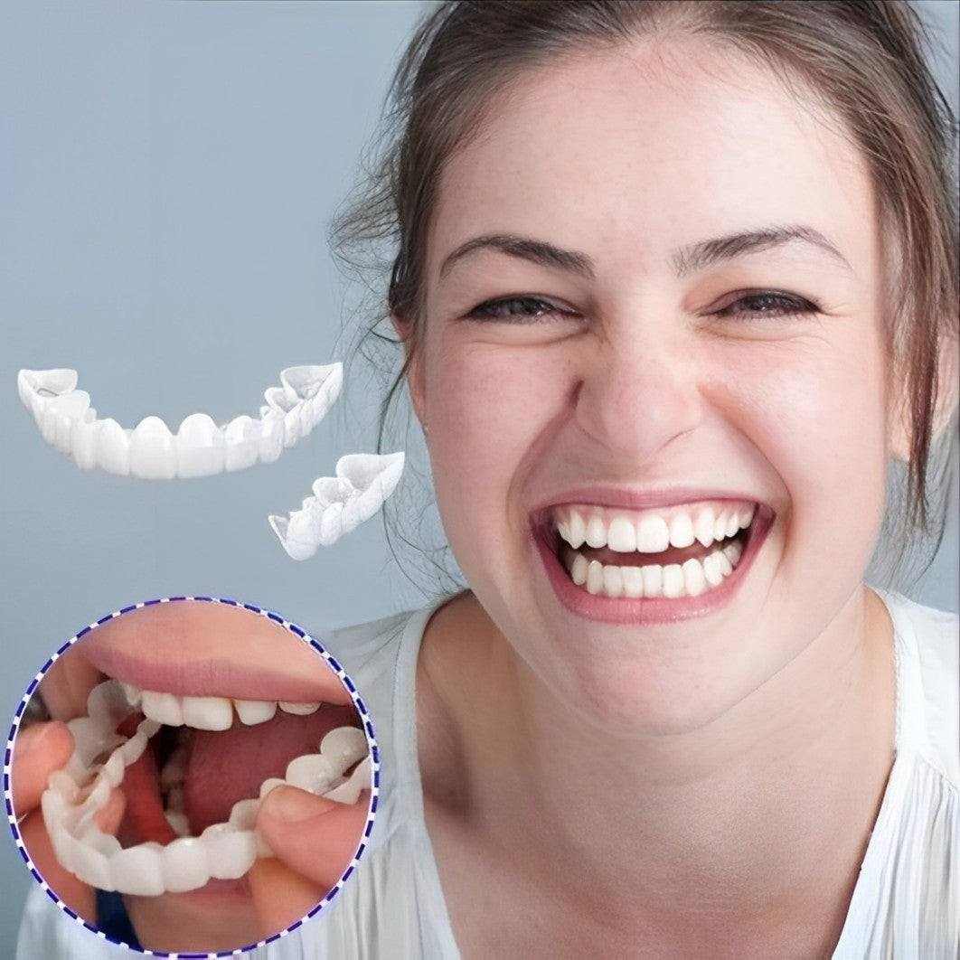 Clip-On Smile Veneers - Upper & Lower Set