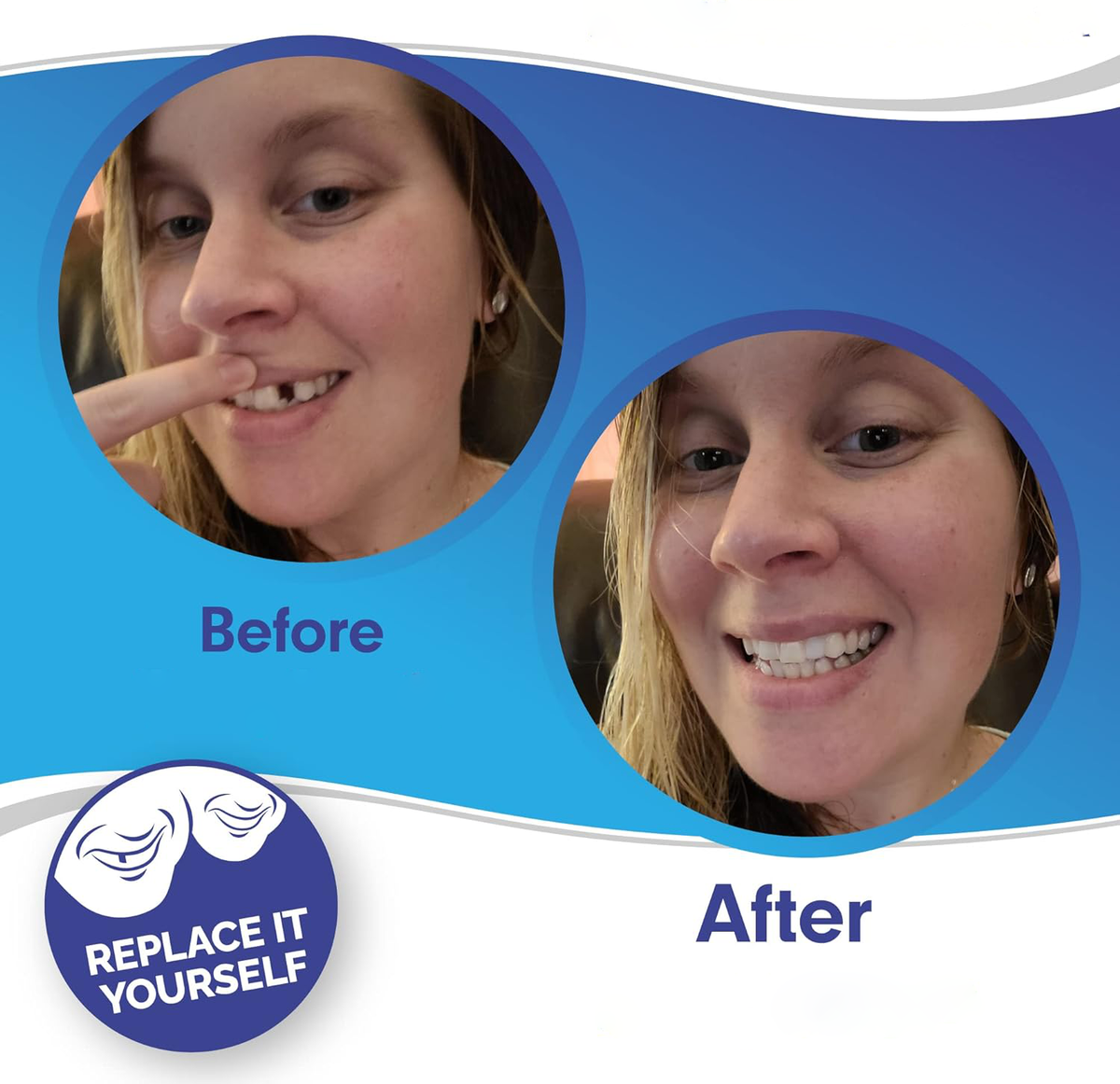 Clip-On Smile Veneers - Upper & Lower Set