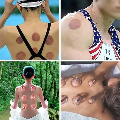 32-Glass Vacuum Cupping Set - Full Body Massage Kit